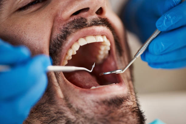 Best Urgent Dental Care in Bluefield, VA