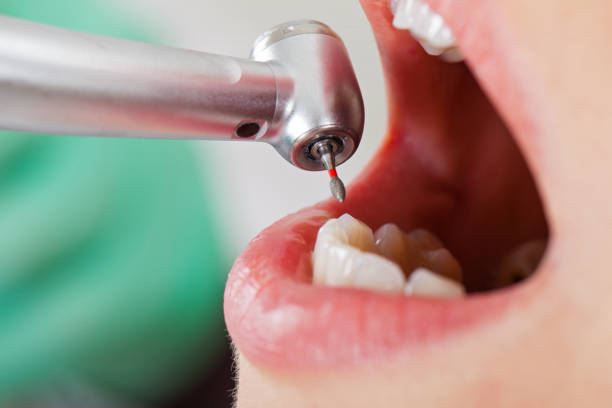 Best Emergency Broken Tooth Repair in Bluefield, VA